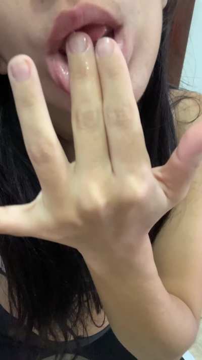 Do you like my braces?