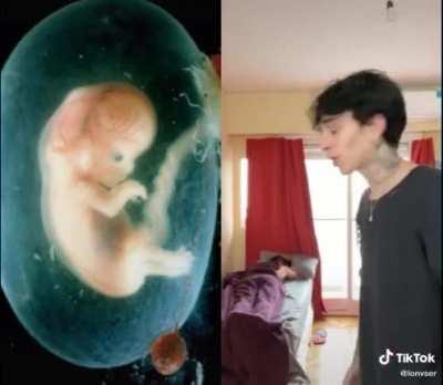 SquarePosting - Video #5310