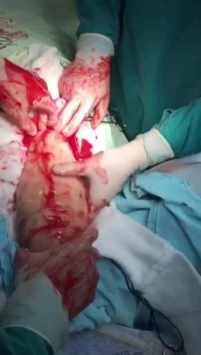 how did it got there ?