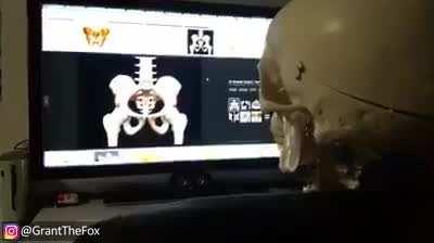 Thanks I hate skeletons at 3am