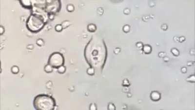 Cancer Cells Being Brutally Destroyed By Genetically Engineered T-cells