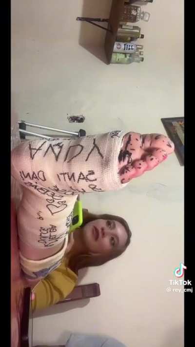 Ticklish foot in a cast