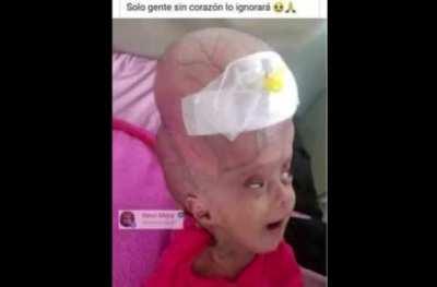 Oh no the zombies are coming!