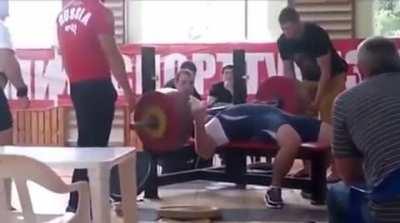 This guy’s chest literally caves in.