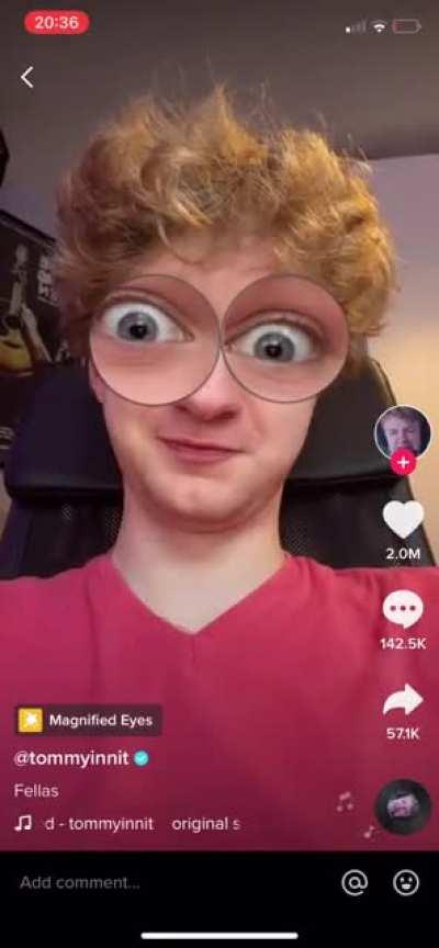 How does this mf have 10 million subscriber 😭😭😭