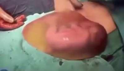 Link me your best red pills for pro life please