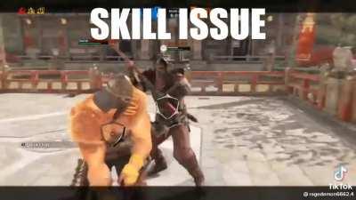 Skill issue.
