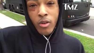 Old TMZ interview with X