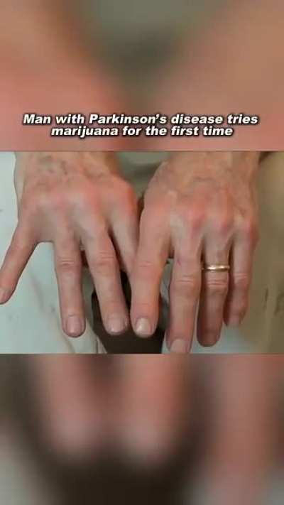 Man with Parkinson’s disease tries cannabis for the first time