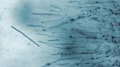 Mycelium growth under the microscope