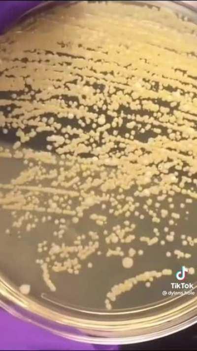 Remember the 2nd grade?