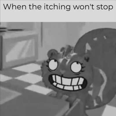 cant feel itchy if you dont have skin