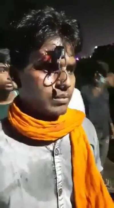 Indian cops thrust key into a man's forehead after a argument