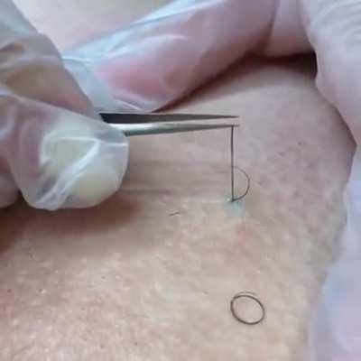 For how long could it be growing?