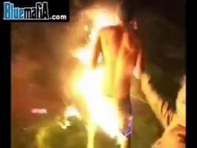 NSFW HMFT after i get 2nd and 3rd degree burns on 44% of my body from a gasoline slip n slide