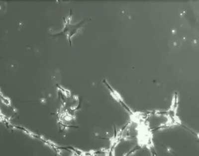 Brain cells in a culture dish trying to form connections with each other.