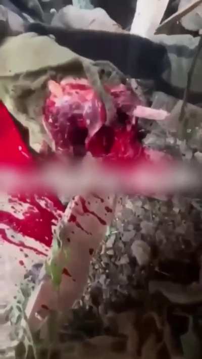 Ukrainian soldier records the moment a mortar lands in his trench and causes severe damage to his comrade's arm.