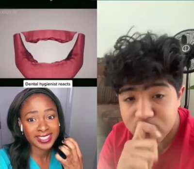 Last chance to look at your teeths Hector