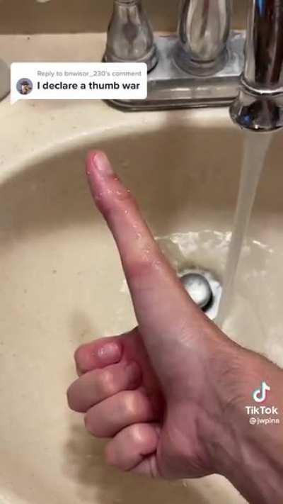 Thanks, I hate this Thumb War