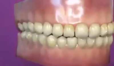 If teeth could breathe 