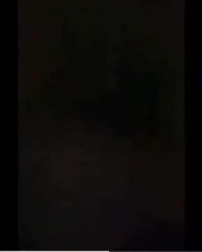 Will shooting my leg hurt?