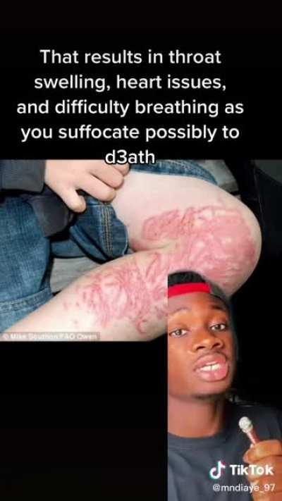 This why moms say don’t pick up everything you see on the ground