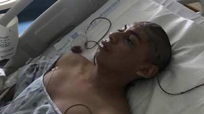 Both angles of 16-year-old boy shot in the head with bean bag round by Austin Police