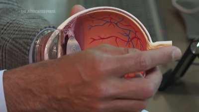Surgeons have performed the world's first eye transplant