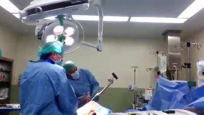 'Surgically' Removing an iron rod used for healing a leg fracture