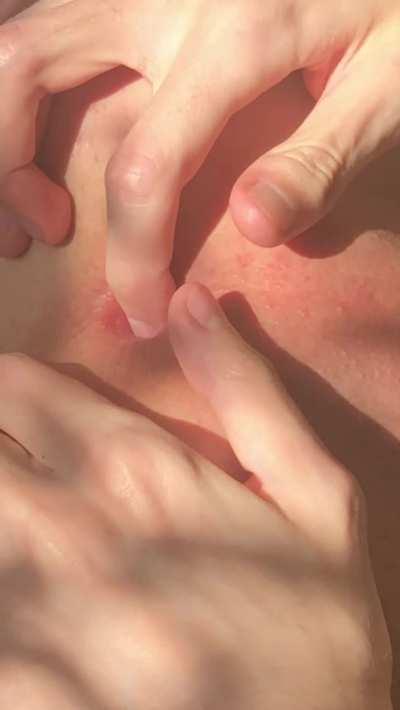 [20] Who likes my pink hole🥰