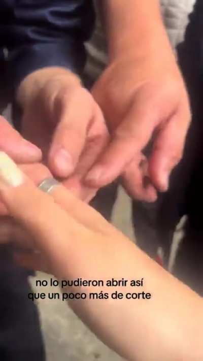 Hurlingham: Bomberos le rescatan el dedo a una mujer que se le había atorado un anillo