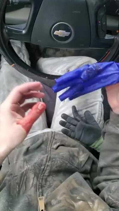 Smashed my thumb with a hammer while on a jobsite.