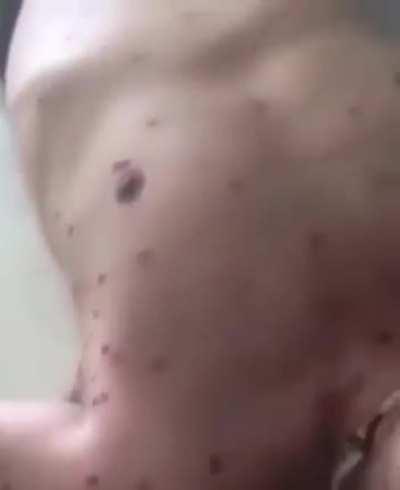 Attacking a swarm of bees