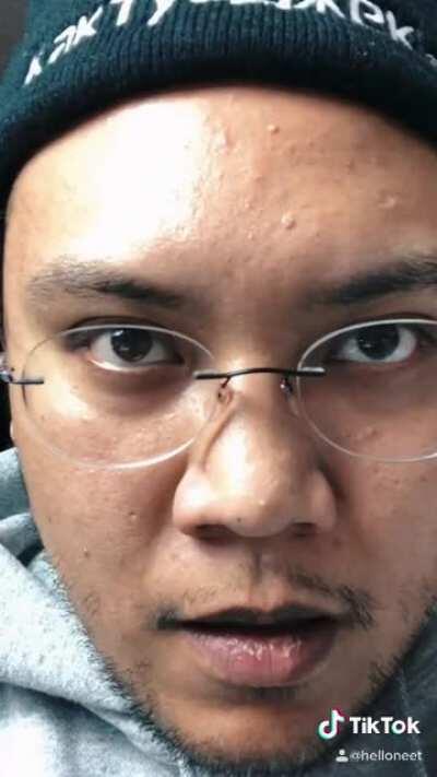 ARE YOU KIDDING ME!?