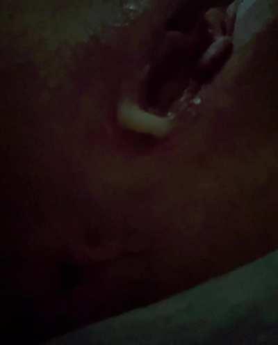 misbie dripping on phone