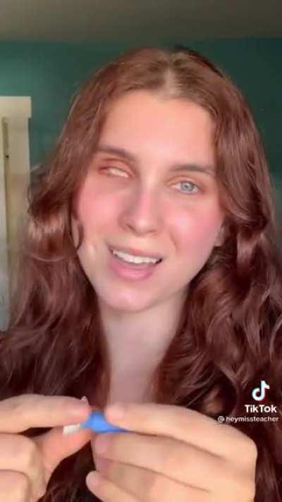 Changing a prosthetic eyeball