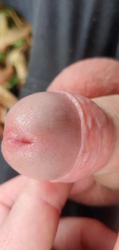 Come and play with some loose skin