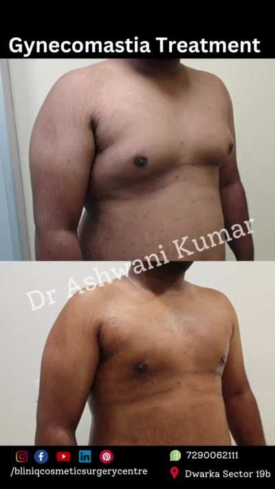 How are the Results ?