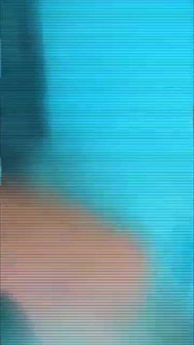 schizophrenia speed episode, lights self on fire 😥