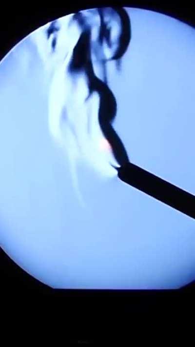 Schlieren images lets you see the invisible