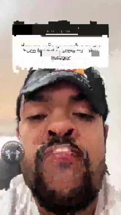 Dizem q ele tem 1,70 