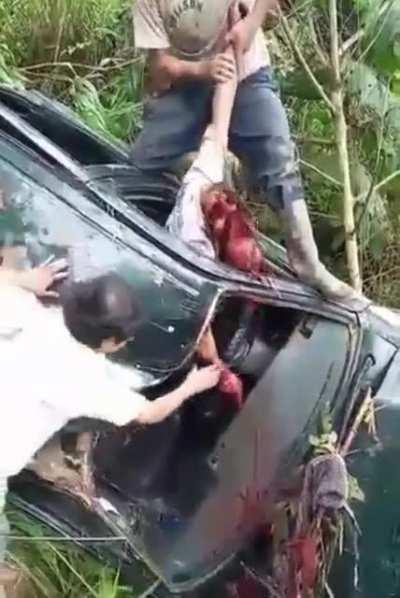 Nasty car crash leaves victim’s skull and loose face hanging from remaining tissue.