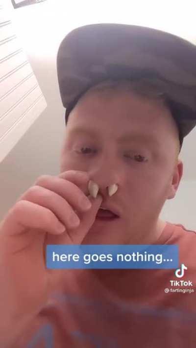 Forget using the netipot