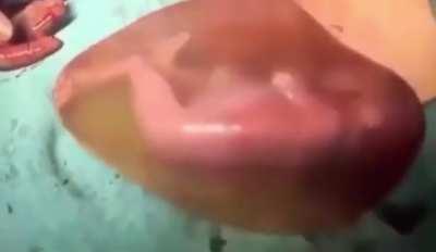 Premature baby born inside amniotic sac, kicking and rolling.