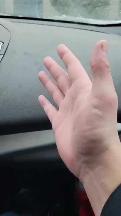 it's so cold today that you can see the heat leaving my hand