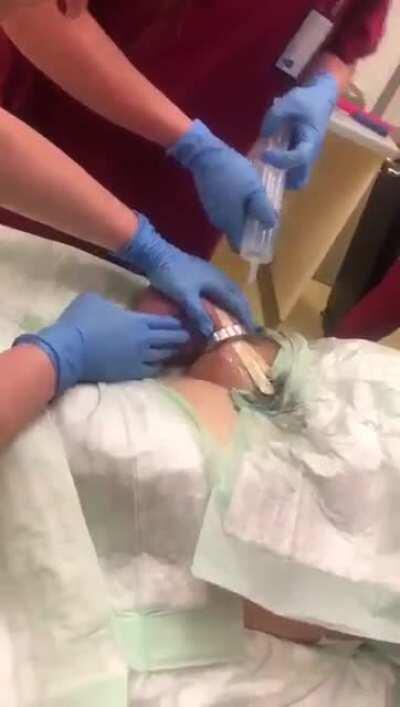 WCGW using a cock ring