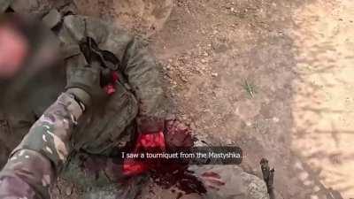 A Russian soldier bled because he attached the tourniquet to his bulletproof vest with construction clamps. At the moment when it was necessary to save himself, the prudent Russian simply could not use it. Maybe he had read a lot of Russian manuals or was