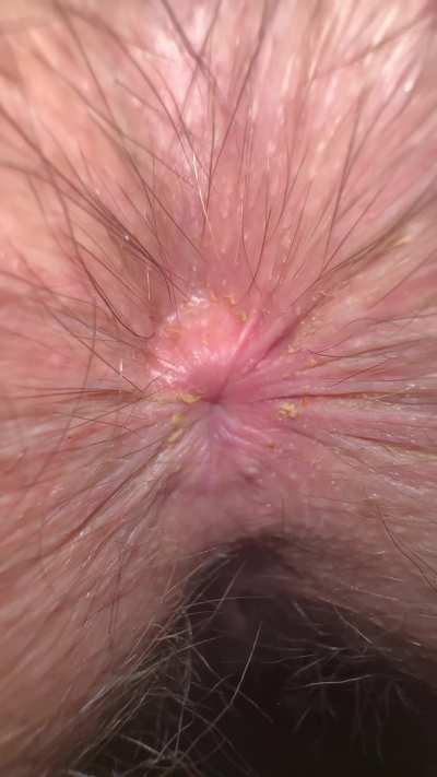 Wifey winking her dirty asshole 