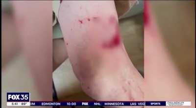 Yeah. Gators. *They’re* the reason why no one wants to move to Florida.