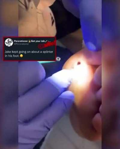 He was complaining about a splinter